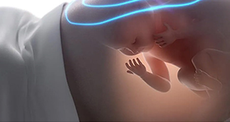 3D/ 4D Scan Image