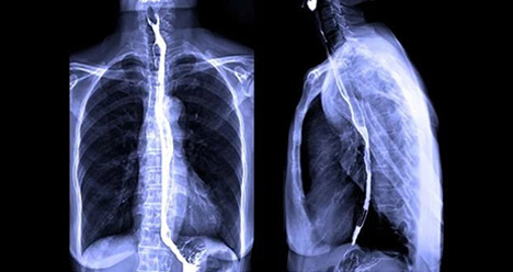 HSG/ Barium Procedures Image