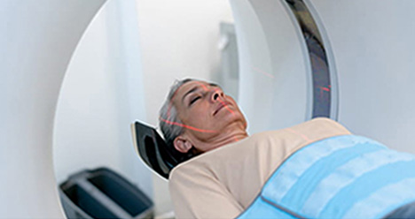 CT Scan Image