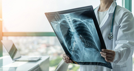 Digital X-Ray Image